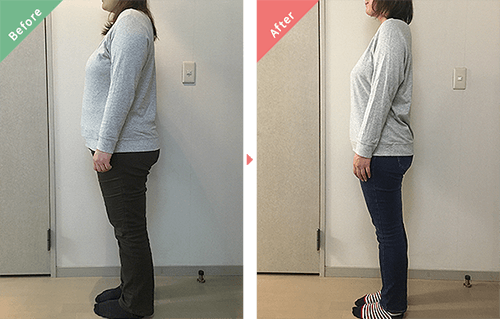 ビフォーアフター