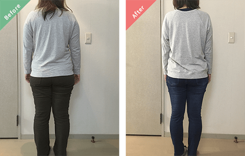 ビフォーアフター